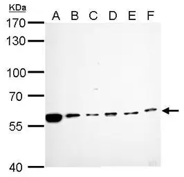 Anti-CDC6 antibody used in Western Blot (WB). GTX108979