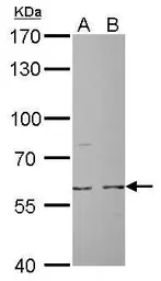Anti-CDC6 antibody used in Western Blot (WB). GTX108979