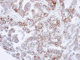 Anti-SNTB2 antibody [N2C3-2] used in IHC (Paraffin sections) (IHC-P). GTX108987