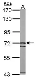 Anti-SLC25A13 antibody [N3C2], Internal used in Western Blot (WB). GTX109001
