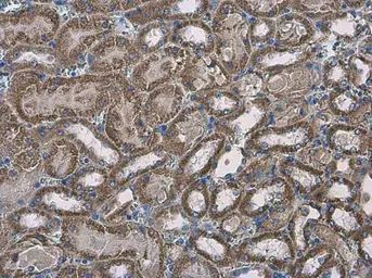 Anti-SLC25A13 antibody [N3C2], Internal used in IHC (Paraffin sections) (IHC-P). GTX109001