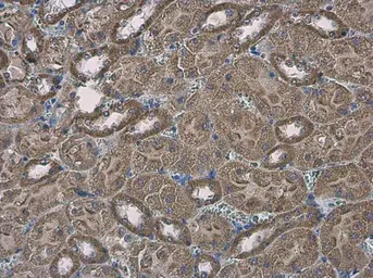 Anti-SLC25A13 antibody [N3C2], Internal used in IHC (Paraffin sections) (IHC-P). GTX109001