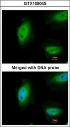 Anti-p73 antibody [N1C1] used in Immunocytochemistry/ Immunofluorescence (ICC/IF). GTX109045