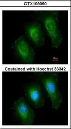 Anti-14-3-3 epsilon antibody [N1C3] used in Immunocytochemistry/ Immunofluorescence (ICC/IF). GTX109090