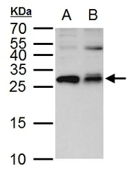 Anti-ETHE1 antibody used in Western Blot (WB). GTX109095
