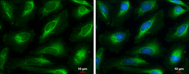 Anti-HMGCL antibody used in Immunocytochemistry/ Immunofluorescence (ICC/IF). GTX109096