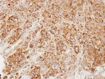Anti-HMGCL antibody used in IHC (Paraffin sections) (IHC-P). GTX109096