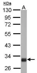 Anti-HMGCL antibody used in Western Blot (WB). GTX109096