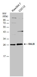 Anti-RALB antibody [N1C3] used in Western Blot (WB). GTX109101