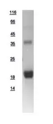 Human LMO2 protein, His tag. GTX109109-pro