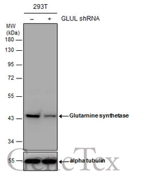 Anti-Glutamine synthetase antibody used in Western Blot (WB). GTX109121