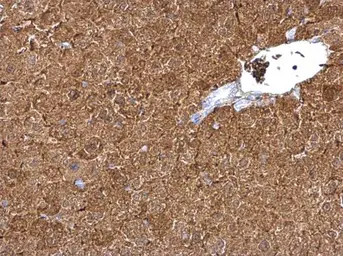 Anti-L-FABP antibody [N1C3] used in IHC (Paraffin sections) (IHC-P). GTX109142
