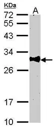 Anti-BCL10 antibody [N1C3] used in Western Blot (WB). GTX109159