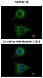 Anti-SBDS antibody [N1C3] used in Immunocytochemistry/ Immunofluorescence (ICC/IF). GTX109168