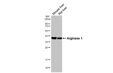 Anti-Arginase 1 antibody used in Western Blot (WB). GTX109242