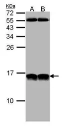 Anti-NHP2L1 antibody [N1C3] used in Western Blot (WB). GTX109247