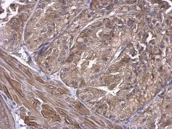 Anti-UBE2D1 antibody used in IHC (Paraffin sections) (IHC-P). GTX109257