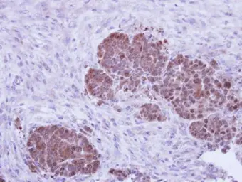 Anti-ZNF259 antibody [N3C3] used in IHC (Paraffin sections) (IHC-P). GTX109364