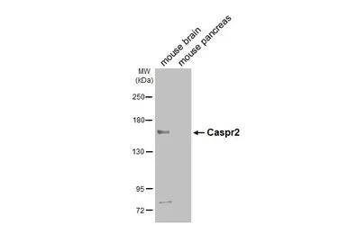 Anti-Caspr2 antibody [N2N3] used in Western Blot (WB). GTX109389