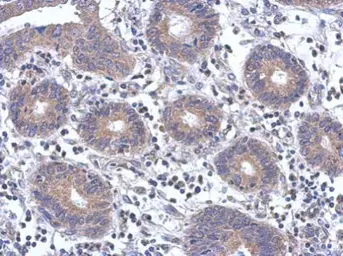 Anti-FYN antibody [N1C2] used in IHC (Paraffin sections) (IHC-P). GTX109428
