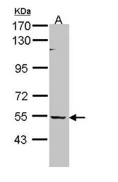 Anti-BAIAP2L1 antibody [N1C1] used in Western Blot (WB). GTX109453