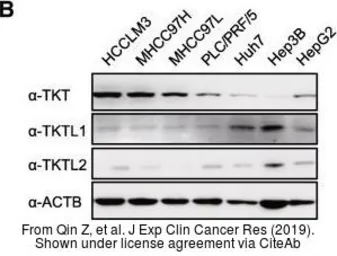 Anti-TKTL1 antibody [N1C1] used in Western Blot (WB). GTX109459