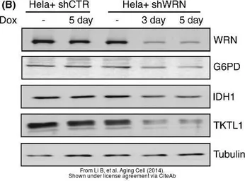 Anti-TKTL1 antibody [N1C1] used in Western Blot (WB). GTX109459