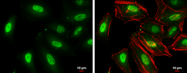 Anti-TKTL1 antibody [N1C1] used in Immunocytochemistry/ Immunofluorescence (ICC/IF). GTX109459