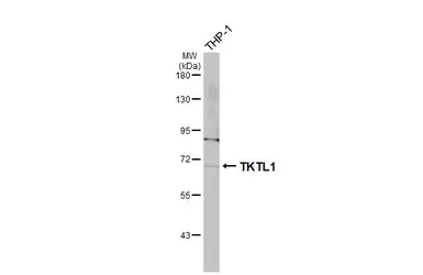 Anti-TKTL1 antibody [N1C1] used in Western Blot (WB). GTX109459
