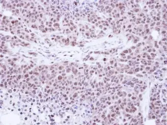 Anti-TKTL1 antibody [N1C1] used in IHC (Paraffin sections) (IHC-P). GTX109459