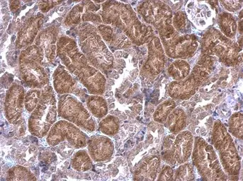 Anti-SCAP antibody [C2C3], C-term used in IHC (Paraffin sections) (IHC-P). GTX109474