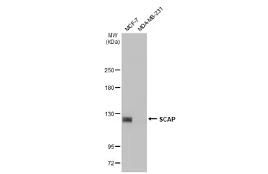 Anti-SCAP antibody [C2C3], C-term used in Western Blot (WB). GTX109474