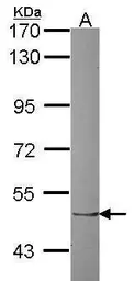 Anti-ZNF212 antibody [N1C1] used in Western Blot (WB). GTX109506