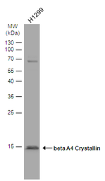 Anti-beta A4 Crystallin antibody [N1C3-2] used in Western Blot (WB). GTX109526