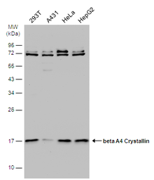 Anti-beta A4 Crystallin antibody [N1C3-2] used in Western Blot (WB). GTX109526