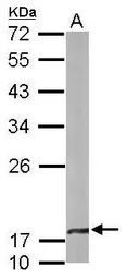 Anti-beta A4 Crystallin antibody [N1C3-2] used in Western Blot (WB). GTX109526