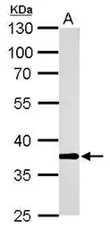 Anti-AKR1B10 antibody used in Western Blot (WB). GTX109571