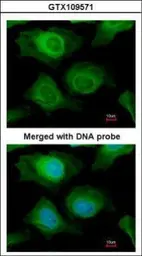 Anti-AKR1B10 antibody used in Immunocytochemistry/ Immunofluorescence (ICC/IF). GTX109571