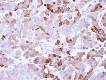 Anti-AKR1B10 antibody used in IHC (Paraffin sections) (IHC-P). GTX109571