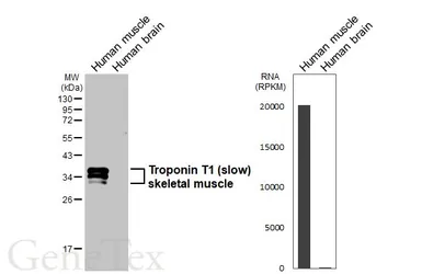 Anti-Troponin T1 (slow) skeletal muscle antibody used in Western Blot (WB). GTX109585