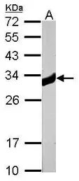 Anti-Ketohexokinase antibody [N1C3] used in Western Blot (WB). GTX109591