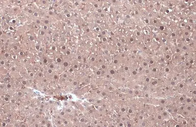 Anti-Ketohexokinase antibody [N1C3] used in IHC (Paraffin sections) (IHC-P). GTX109591