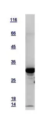 Human Tropomyosin 3 protein, His tag. GTX109592-pro