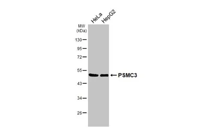 Anti-PSMC3 antibody [N1C2] used in Western Blot (WB). GTX109605