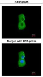 Anti-PSMC3 antibody [N1C2] used in Immunocytochemistry/ Immunofluorescence (ICC/IF). GTX109605