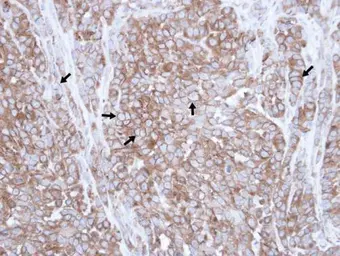 Anti-Caveolin 3 antibody [N1N2], N-term used in IHC (Paraffin sections) (IHC-P). GTX109650