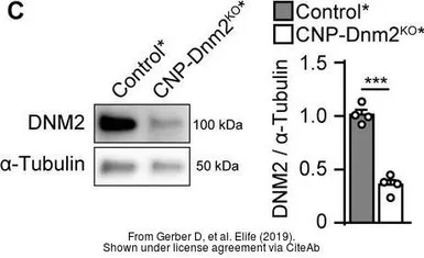 Anti-Dynamin 2 antibody [C2C3], C-term used in Western Blot (WB). GTX109652