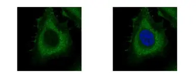 Anti-Dynamin 2 antibody [C2C3], C-term used in Immunocytochemistry/ Immunofluorescence (ICC/IF). GTX109652