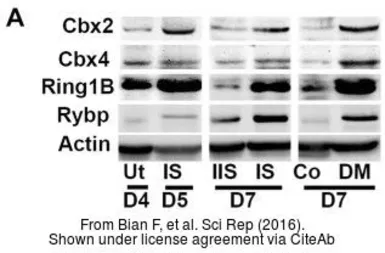 Anti-CBX4 antibody [C3], C-term used in Western Blot (WB). GTX109662