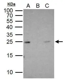 Anti-RAB5A antibody used in Immunoprecipitation (IP). GTX109665
